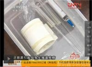 人工授精技術(shù)